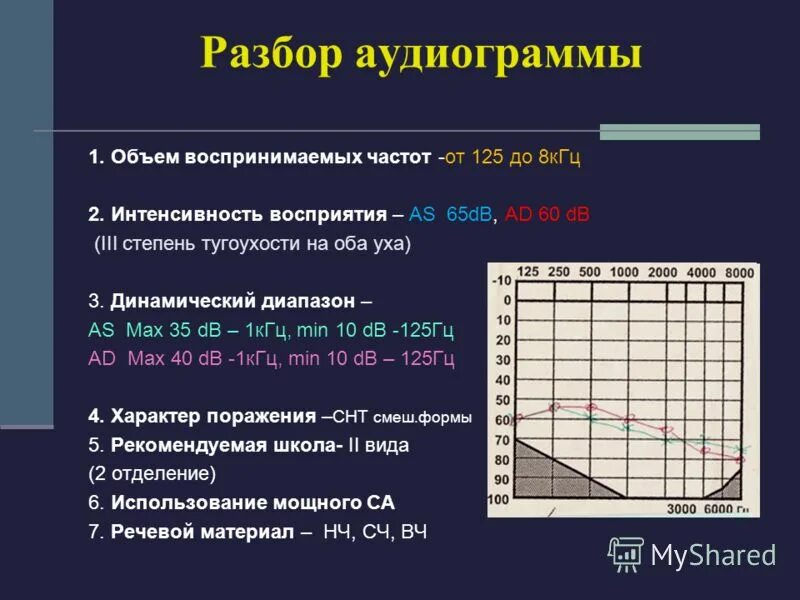 двухсторонняя тугоухость 3 степени. степени тугоухости таблица. кондуктивная тугоухость 1 степени аудиограмма.