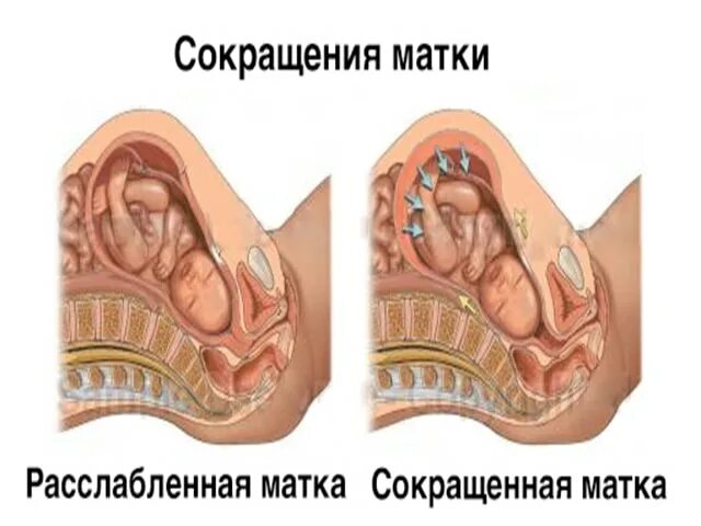 Сколько сокращается матка после вторых