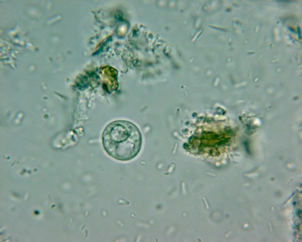 цисты амебы в кале. цисты лямблий микроскопия кала. кишечная амеба препарат. Entamoeba histolytica в кале. микроскопия кала цисты амеба.