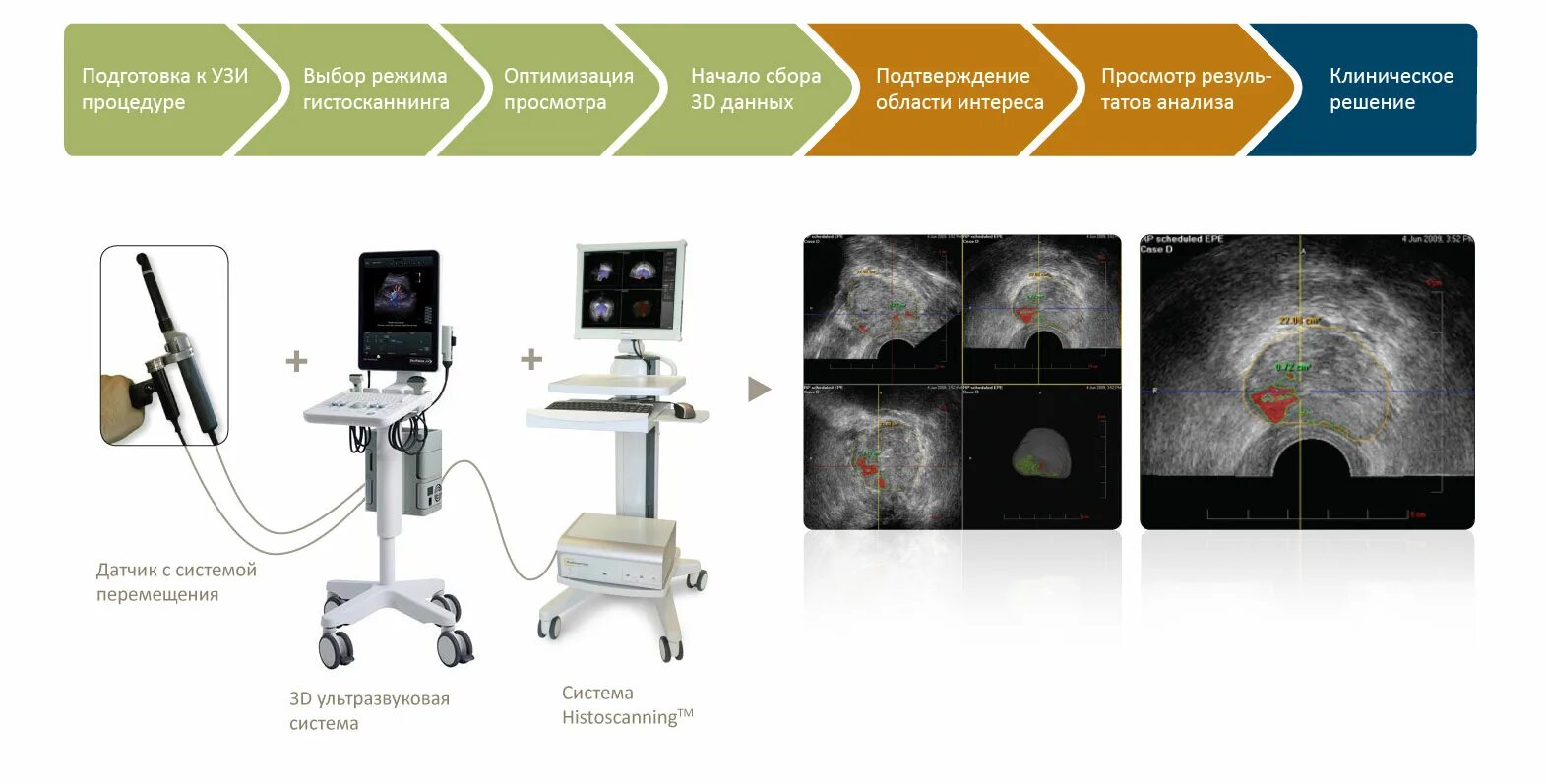 Курс обучения узи. Подготовка к ультразвуковому исследованию. Гистосканирование предстательной железы. Обучение УЗИ. Гистосканирование предстательной железы как проводится.