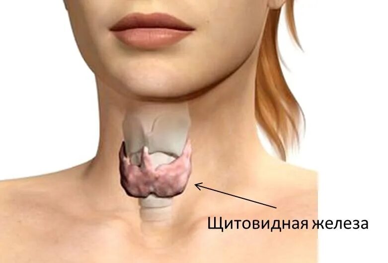 Как вылечить зоб