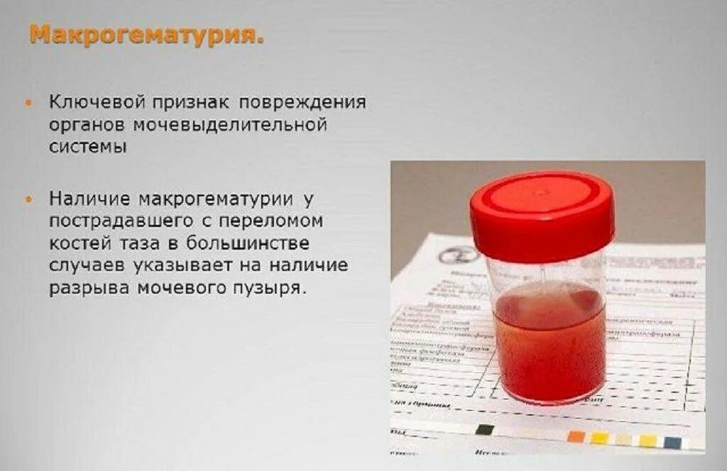 Почему писаешь кровью девушка