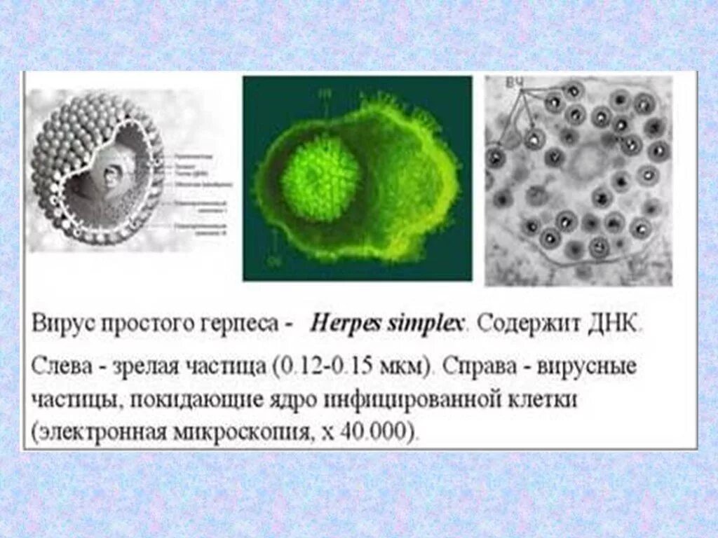 Вирус герпеса под микроскопом Herpes Simplex Изображения: просматривайте стоковые фотографии, векторные изобра
