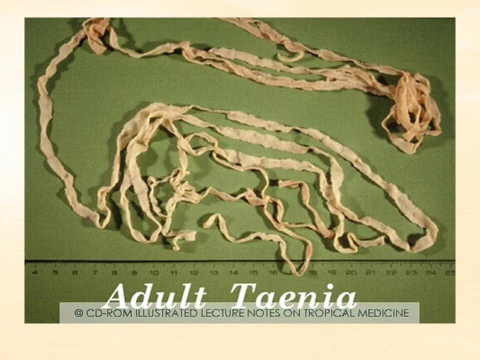 как выглядит бычий цепень фото. ленточный червь бычий цепень. бычий цепень глист фото. бычий цепень проглоттиды. ленточные черви солитеры.