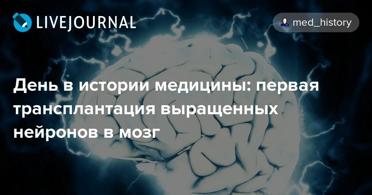 Пересадка клеток мозга. Трансплантация головного мозга. Впервые в мире произведена пересадка клетки человеческого мозга.. Когда была первая пересадка головного мозга.