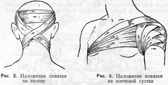 Перевязка шеи. Наложение повязки на плечо. Асептическая повязка на плечо. Повязки на шею хирургия. Перевязка плеча.