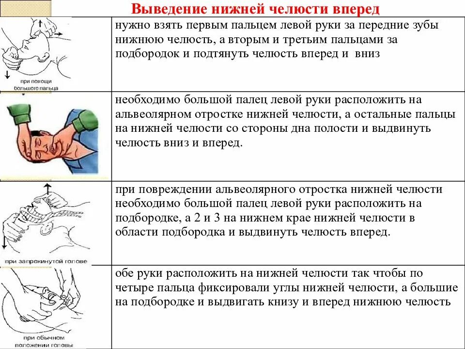 Выдвижение вперед. Выведение нижней челюсти при ивл. выдвинуть нижнюю челюсть вперед при первой помощи. выведение вперёд нижней челюсти. выдвижение нижней челюсти вперед.