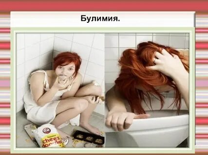 Булимия
