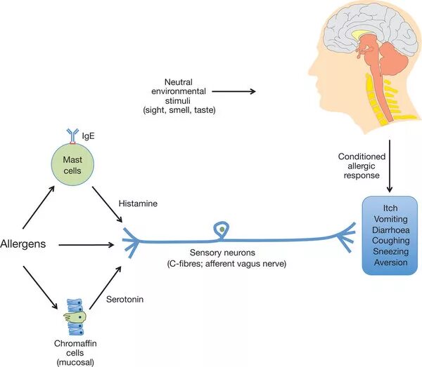 Рефлекс чихания схема. Кашлевой рефлекс схема. Чихание патогенез. Рефлекторная дуга кашлевого рефлекса.