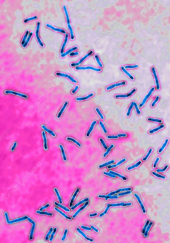 Сапрофитный стафилококк на кровяном агаре. Энтерококки микробиология. Термофильный стрептококк. 13. Стафилококк ауреус под микроскопом.
