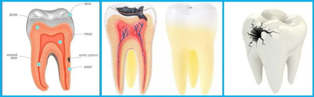 Как отличить зубную боль от воспаления