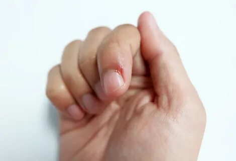 Finger m