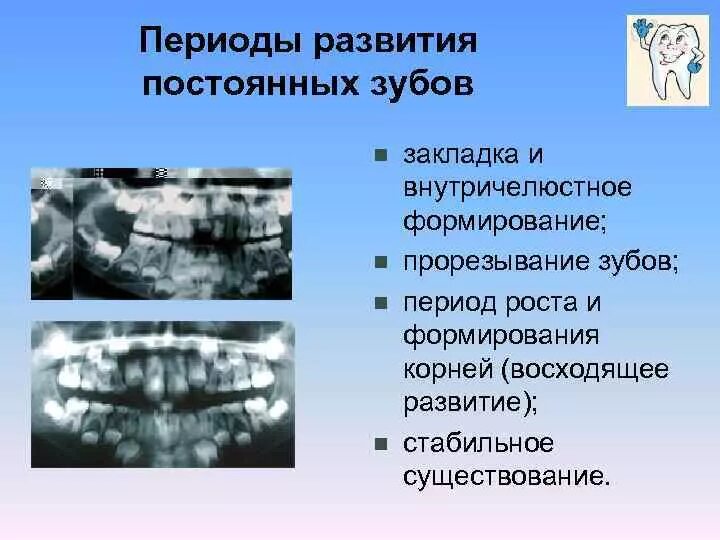 У ребенка нет зачатка постоянного зуба