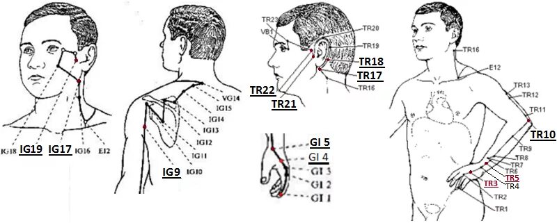 точка тр 1. тянь-чжу точка акупунктуры. меридиан трех частей тела. точка mc6 нэй-гуань. 3 точка меридиан тройной обогреватель.