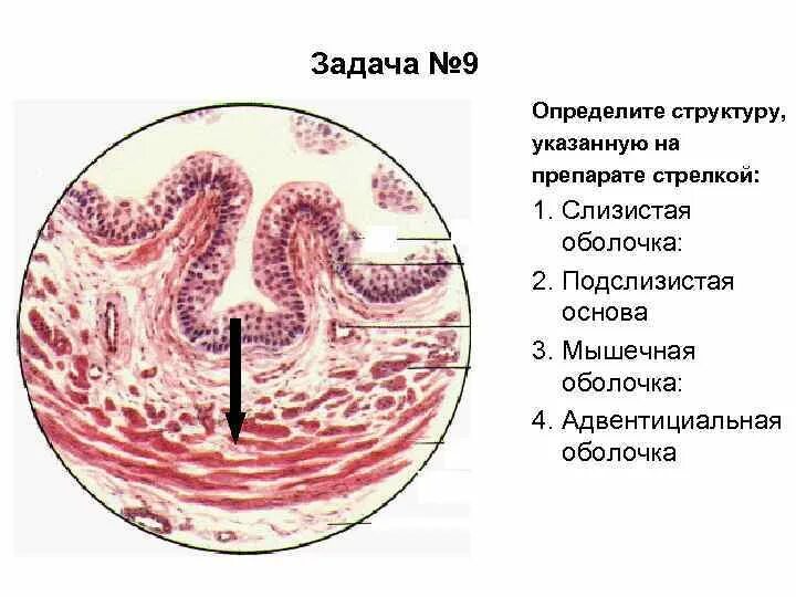 Подслизистая оболочка. Слизистая мышечная адвентициальная оболочки. Мышечная оболочка влагалища. Подслизистая резекция.