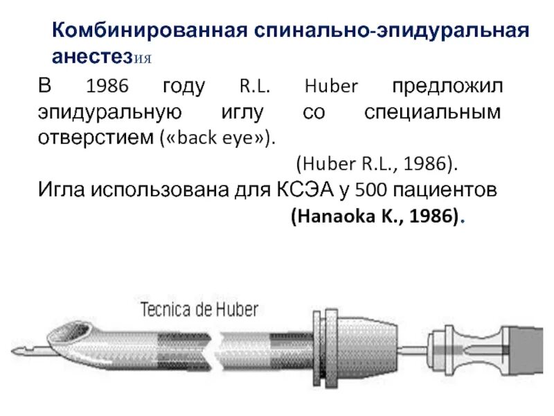 Анестезия инструменты. Комбинированная спинально-эпидуральная анестезия иглы. игла для эпидуральной анестезии. оснащение для эпидуральной анестезии. эпидуральная анестезия игла.