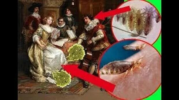 Прокладки в древности. Средние века немытая европа. Как отличить месячные от кровотечения. Обильные менструальные кровотечения. Сношение в средние века.