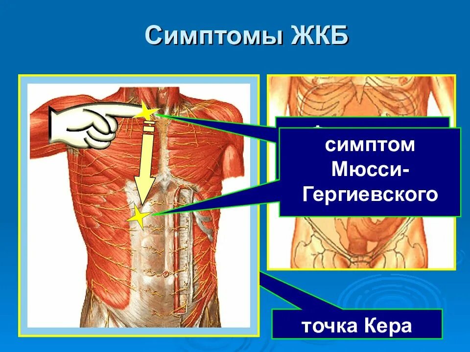 Болевые точки и болевые симптомы. Симптом керра при холецистите. Точка кера мейо робсона дежардена. Точка кера. Точка кера мейо робсона дежардена.