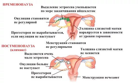 Менопауза матка. Пременопауза. пременопауза менопауза постменопауза. постменопауза изменение в матке. матка в период менопаузы.