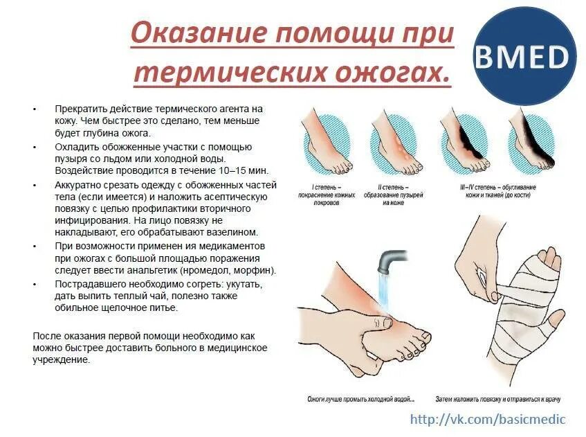 Первая помощь при ожогах. Первая медицинская помощь при ожогах. Первая помощь термических ожогов.