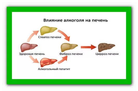 Можно ли посадить печень. Влияния спирта на печень рисунок. как быстро сажается печень.