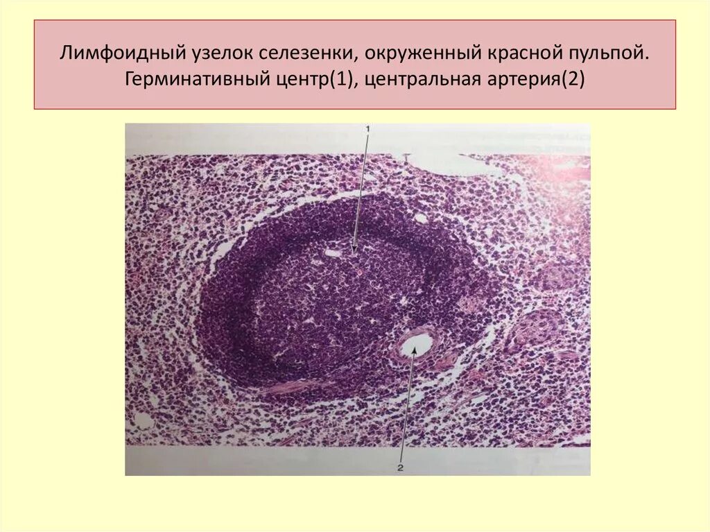 Лимфоидный узел селезенки гистология. Лимфатические фолликулы селезенки. Препарат селезёнка окраска гематоксилин-эозин. Лимфатические фолликулы селезенки. Лимфатические фолликулы селезенки.