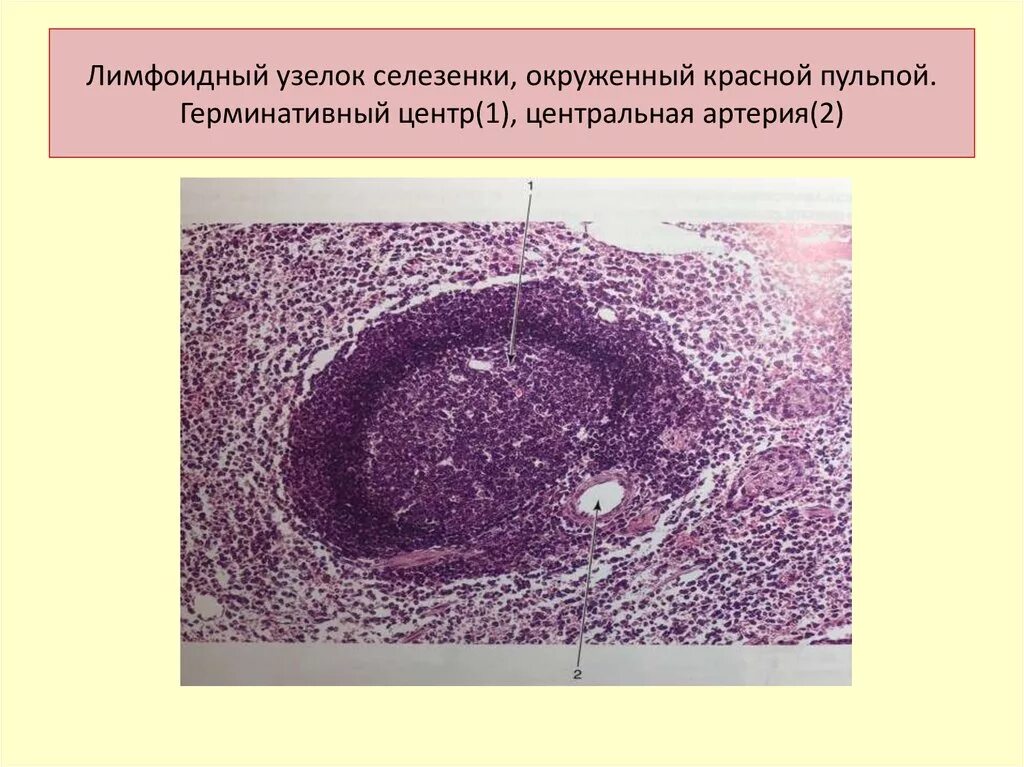 Лимфоидный узелок селезенки. Герминативный центр лимфоидного фолликула. Герминативный центр селезенки. Лимфоидный фолликул лимфатического узла гистология. В селезенке образуются клетки