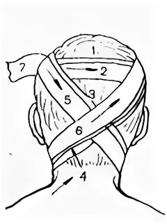 Крестообразная повязка на затылок алгоритм. Восьмиобразная повязка на затылок и шею. Крестовидная повязка на затылок. Крестообразная повязка на голову. Крестообразная на затылок