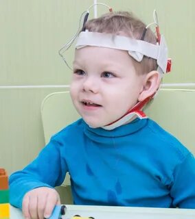 Микрополяризация головного мозга