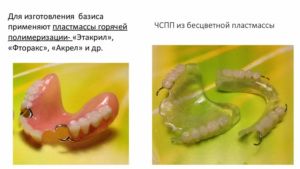 Клинико лабораторные этапы съемных пластиночных протезов. Этапы изготовления пластиночных протезов. Съемный пластиночный протез этапы. Частичный съемный пластиночный протез. Частичный съемный пластинчатый протез.