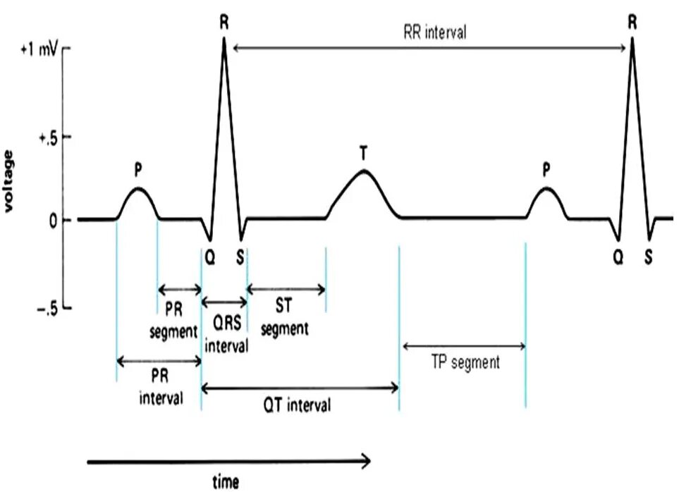 Патология QRS на ЭКГ. Комплекс QRS на ЭКГ. Электрокардиограмма PQ QRS qt. Комплекс QRS на ЭКГ норма. Экг сочи