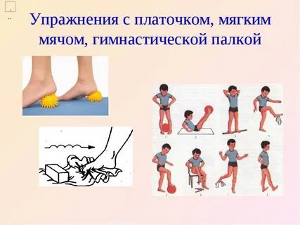 Плоскостопие ходьба