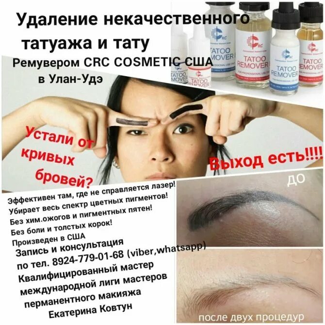 Лазерное Удаление. Татуажа бровей. До и сразу после удаления. Г. Черемхово ул. Л