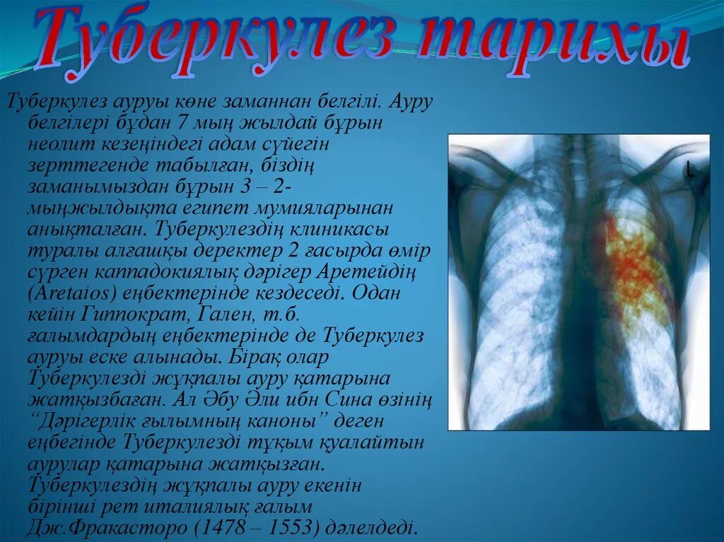 Туберкулез tuberculosis. Туберкулез презентация. Туберкулез слайды для презентации. Туберкулез казакша презентация.