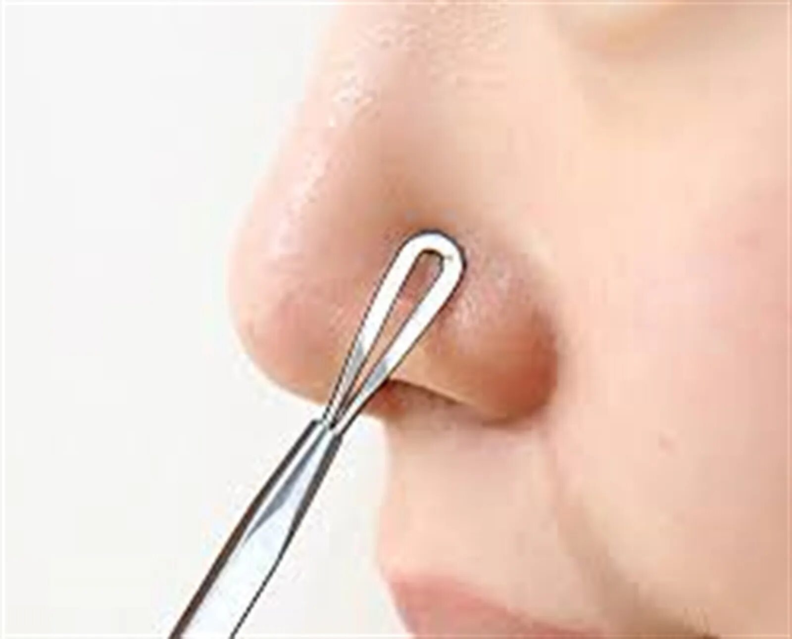 Blackhead Remover механический.