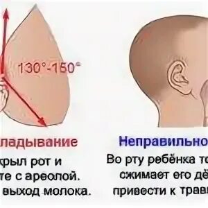 Белеет сосок после кормления