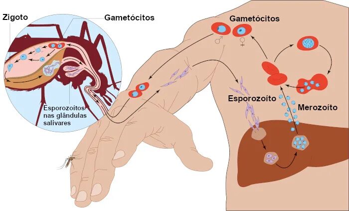 Малярия локализация. Малярия локализация в организме человека.
