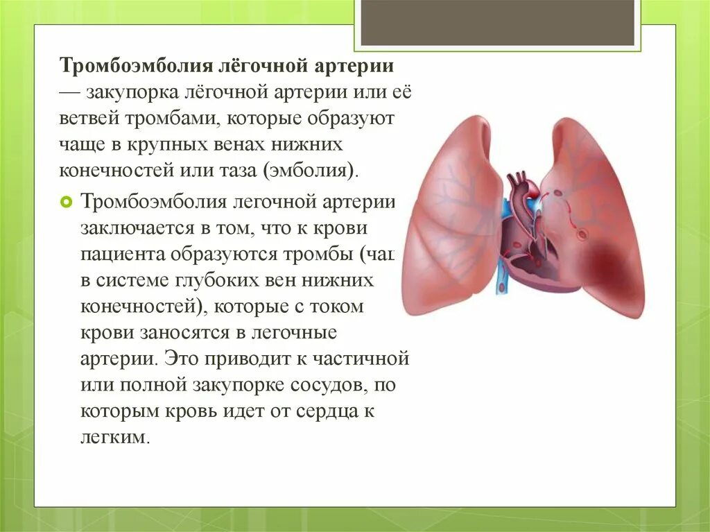 Что такое тромбоэмболия легочной артерии простыми словами. Тромбоэмболия легочной артерии. Тромбоэмболия ветвей легочной артерии. Омбоэмболия лёгочной артерии. Закупорка легочной артерии.