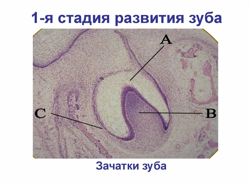 Стадии развития зуба. Стадии развития зуба гистология. Мезенхима зародыша цыпленка препарат. Клетки мезенхимы гистология.