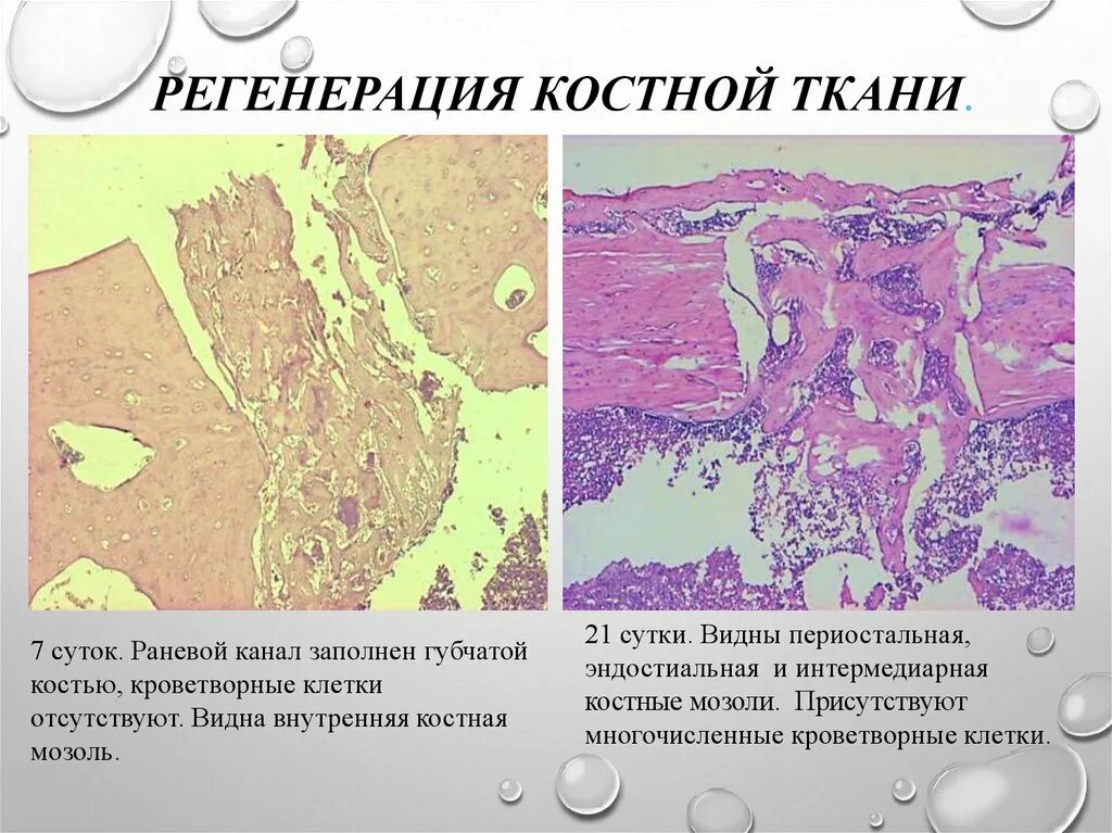 Деминерализация костной ткани. Нкр направленная костная регенерация. Мембрана стоматологическая для тканевой регенерации коллагеновая. Направленная тканевая регенерация пародонтология. Деминерализация костной ткани.