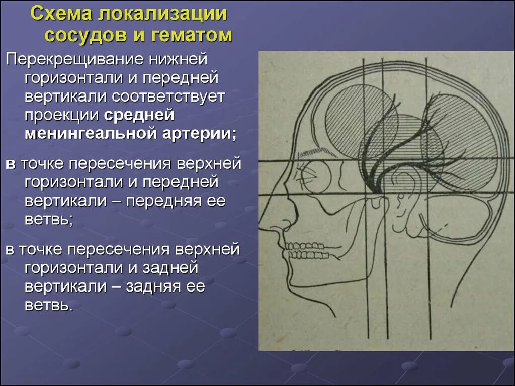 Проекция средней менингеальной артерии по схеме кренлейна. Схема черепно мозговой топографии по кренлейну брюсовой. Средняя оболочечная артерия. Черепно мозговая топография кренлейна. Схема кренлейна-брюсовой.