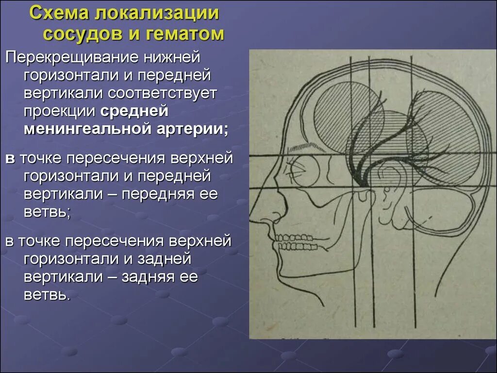 Схема черепно-мозговой топографии кренлейна-Брюсовой. Схема Брюсовой-Кронляйна. Кренлейна Брюсовой. Черепно мозговая топография кренлейна Брюсовой.