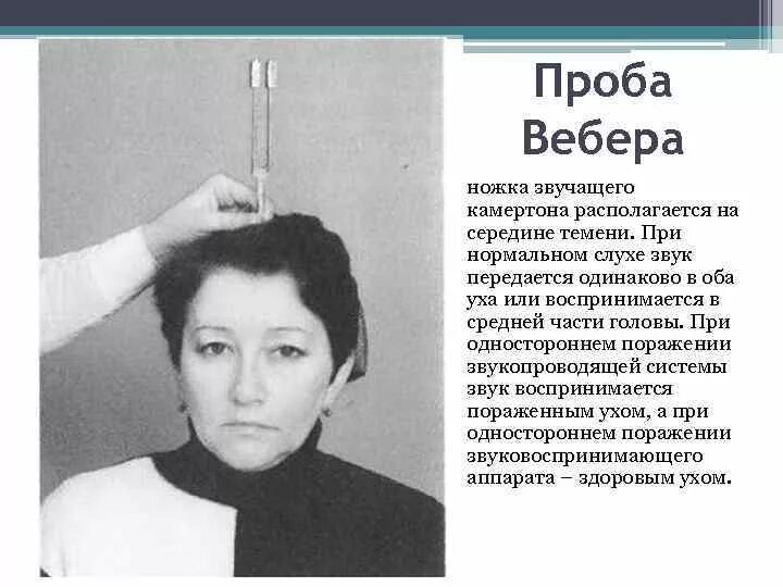 Проба камертонами. Камертоновая проба вебера. проба вебера ринне швабаха. проба вебера камертон. тест камертон.