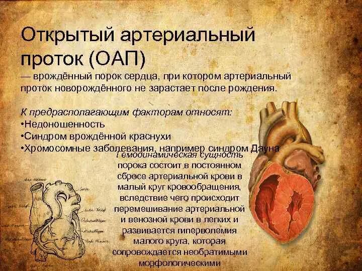 Впс оап