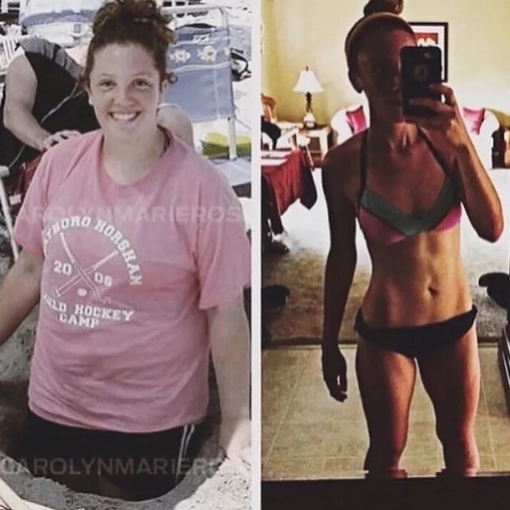 70 фунтов. 19 кг за 36 недели. Ana diet. Растолстела до и после. 19 кг за 36 недели.