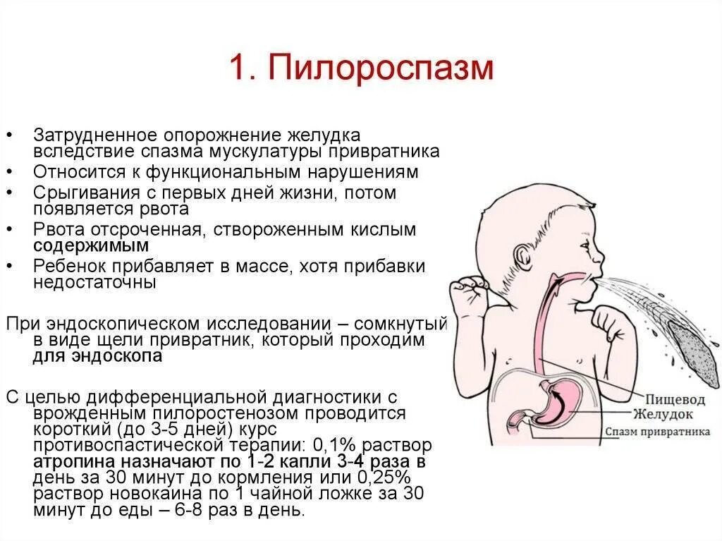 Как отличить рвоту. Пилороспазм симптомы у грудных детей. Пилоростеноз и пилороспазм у новорожденных. Рвота у ребенка грудничка.