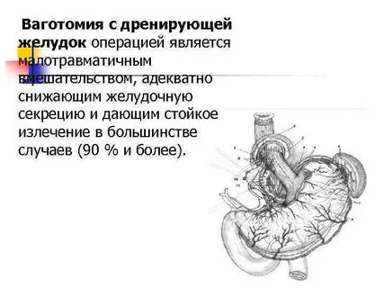После операции желудка осложнения