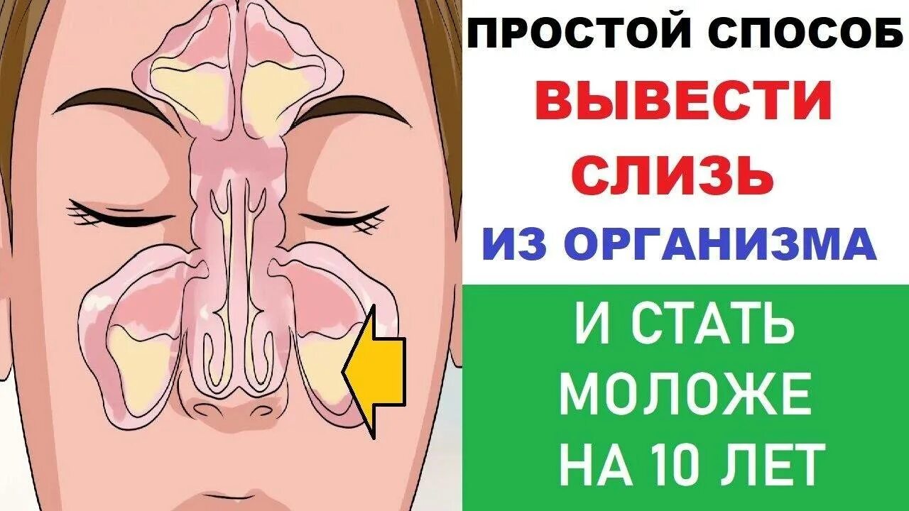Сопли в горле как избавиться. Простые способы избавления от слизи в организме.. средство от слизи в носоглотке. от слизи в горле препараты. лекарства от слизи в глотке.
