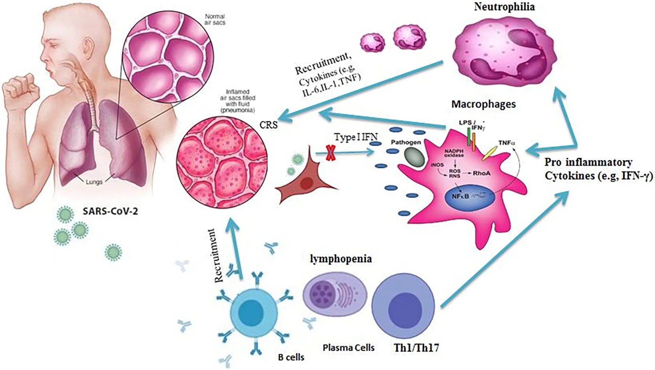 Новая коронавирусная инфекция патогенез. Коронавирус sars cov 2 схемы. Цитокиновый шторм при коронавирусе симптомы. Жизненный цикл sars-cov-2. Инфекция sars cov.