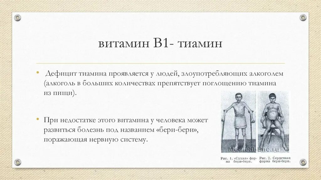 Витамин в1 недостаток болезнь. Дефицит витамина тиамина. При недостатке тиамина развивается. Тиамин при недостатке.